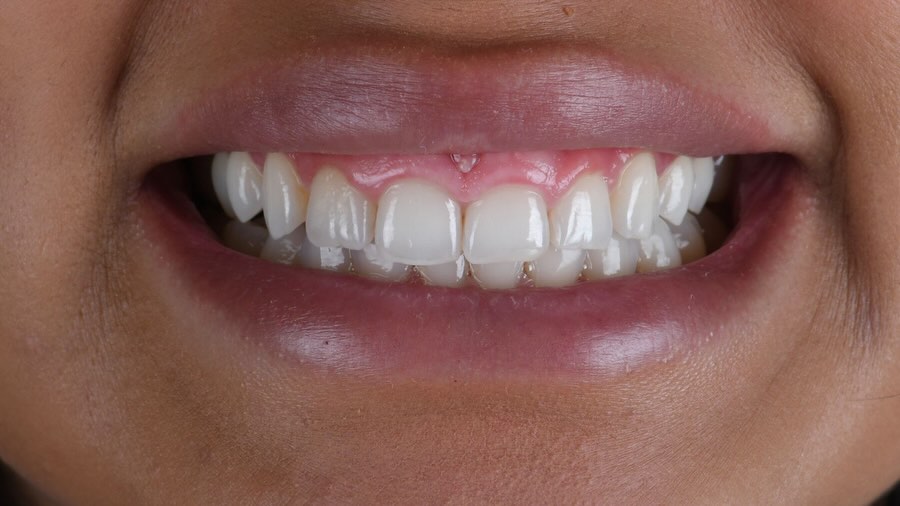 Resultado dental: sonrisa de paciente